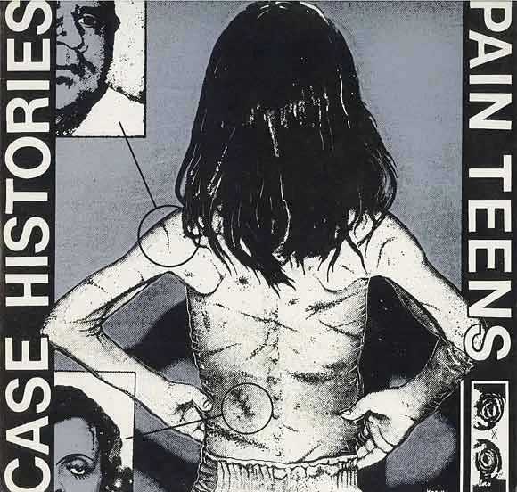 Official album cover art for the release Case Histories by Pain Teens