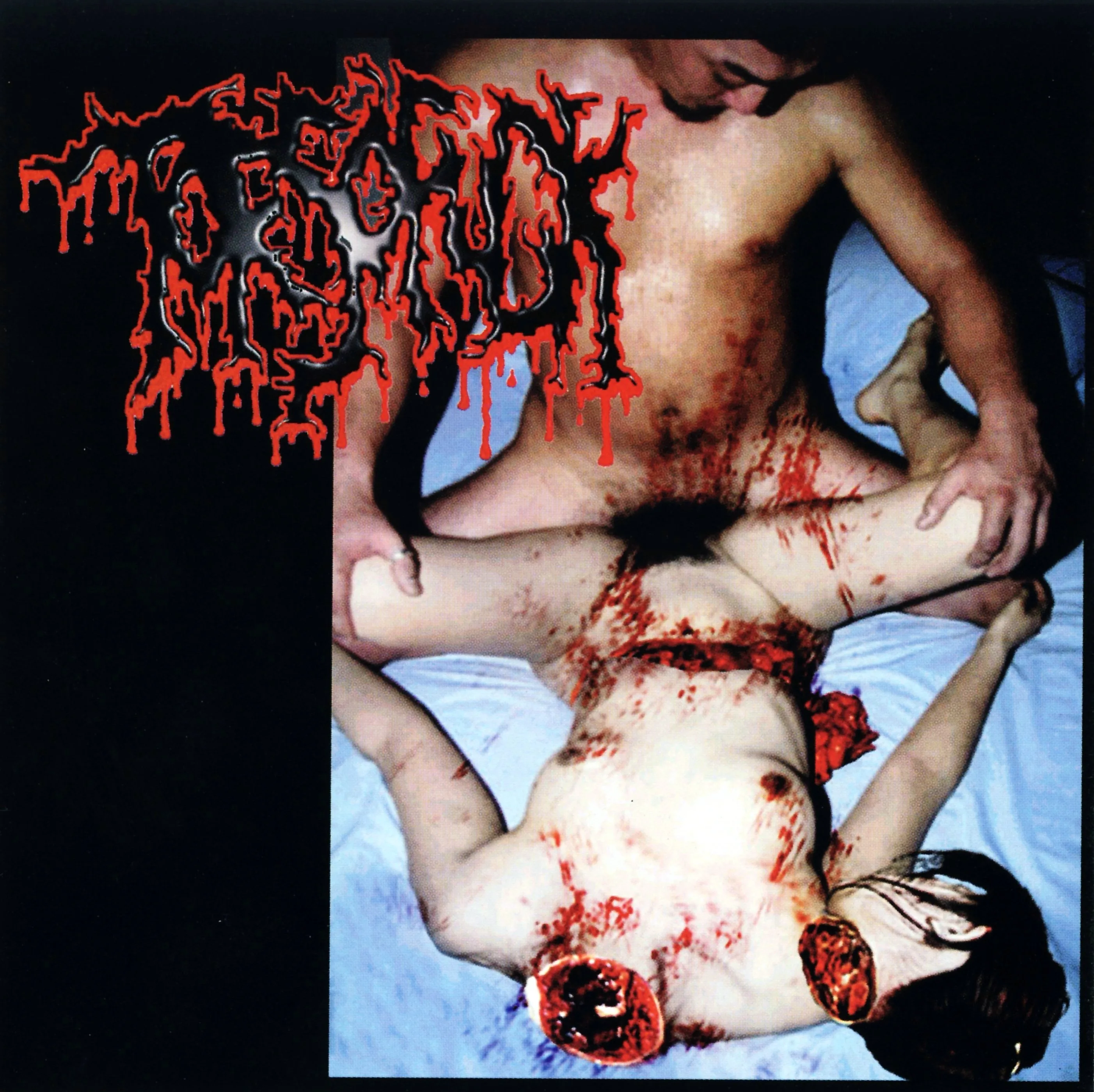 Official album cover art for the release Disgusting Gore and Pathology / Polymorphisms to Severe Sepsis in Trauma by Torsofuck