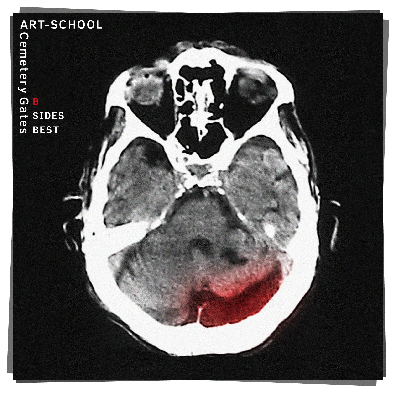Official album cover artwork for Cemetery Gates B SIDES BEST by ART-SCHOOL