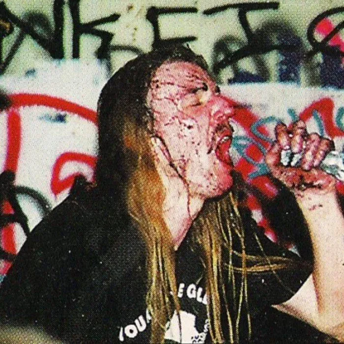 Abscess