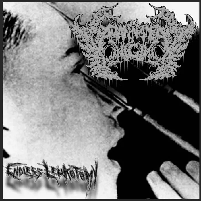 Endless Leukotomy cover