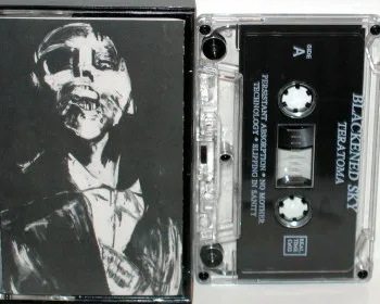 Teratoma cover
