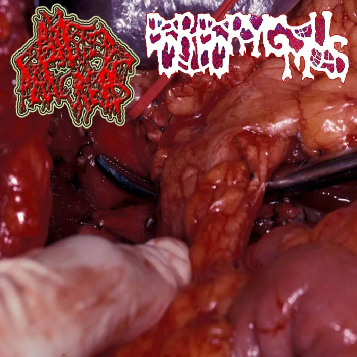 Blasted Pancreas / Borborygmus cover