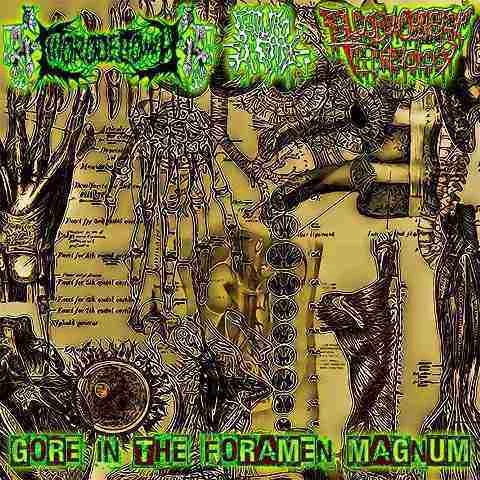 Gore in the Foramen Magnum cover