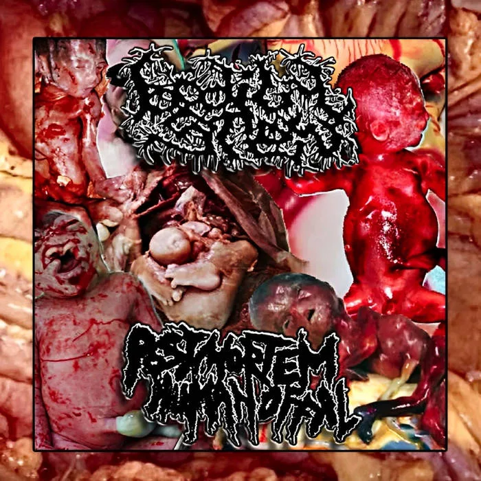 Bodily Stew / Postmortem Human Offal cover