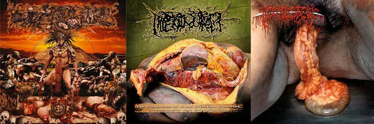 Bowel Stew / Hipermenorrea / Paracoccidioidomicosisproctitissarcomucosis cover