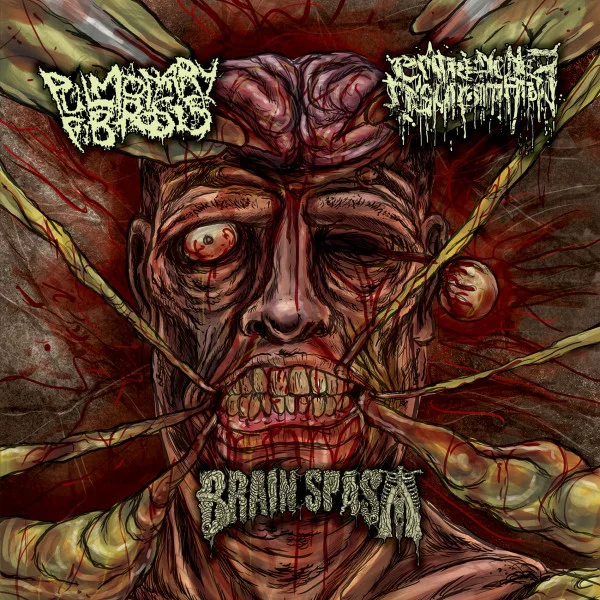 Pulmonary Fibrosis / Entrenched Ingurgitation / Brain Spasm cover