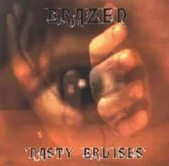 Nasty Bruises cover