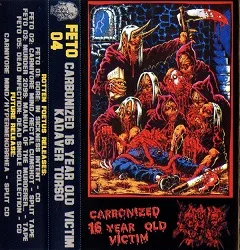 Carbonized 16 Year Old Victim / Kadaver Torso cover