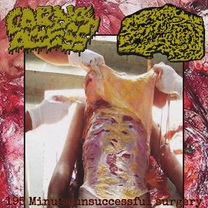 195 Minute Unsuccessful Surgery cover