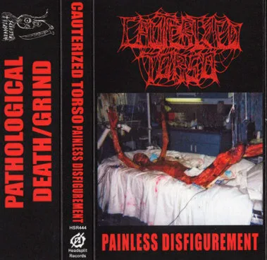 Painless Disfigurement cover