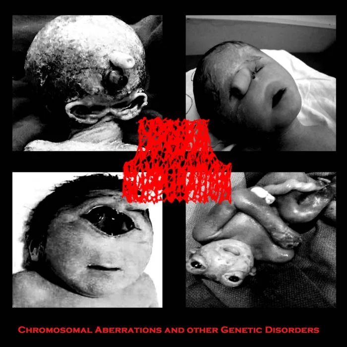 Chromosomal Aberrations and Other Genetic Disorders cover