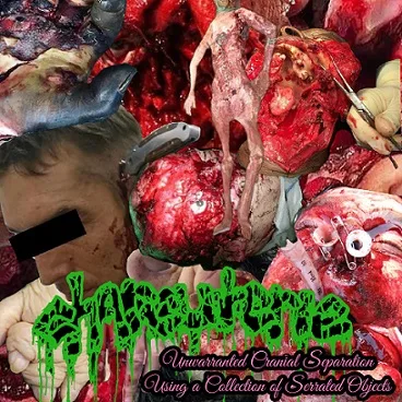 Unwarranted Cranial Separation Using a Collection of Serrated Objects cover
