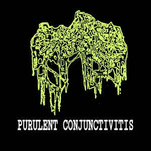 Purulent Conjunctivitis cover