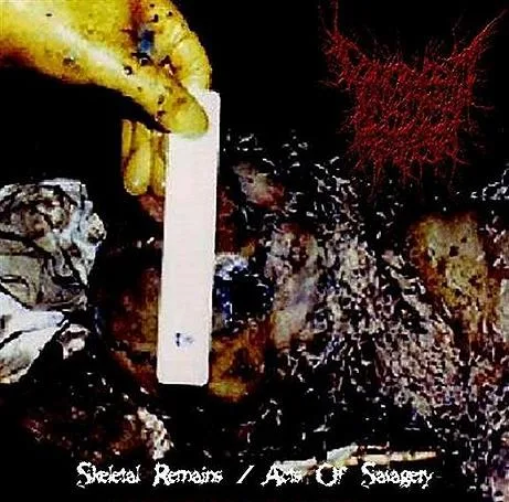 Skeletal Remains / Acts of Savagery cover
