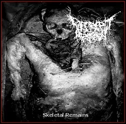 Skeletal Remains cover