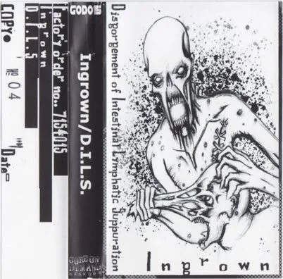Ingrown / Disgorgement of Intestinal Lymphatic Suppuration cover