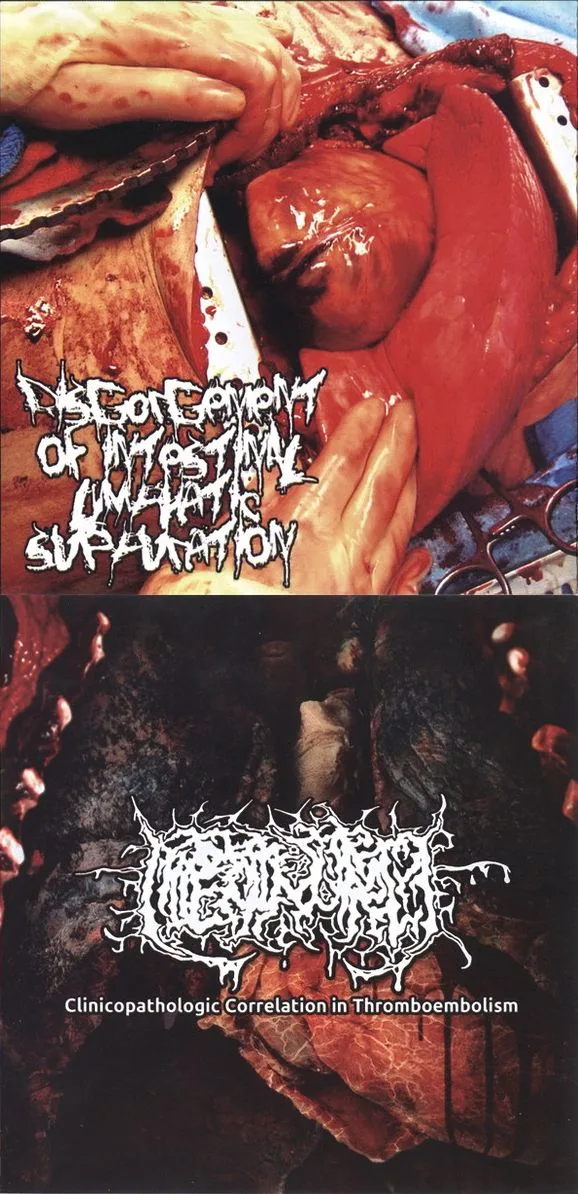 Clinicopathologic Correlation in Thrombeombolism / Untitled cover