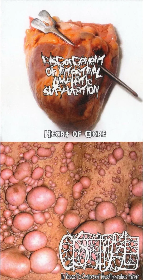 Heart of Gore / In Regard to Omnipresent Neurofibromatous Matters cover