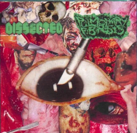 Dissected / Pulmonary Fibrosis cover
