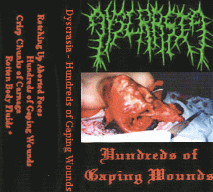 Hundreds of Gaping Wounds cover