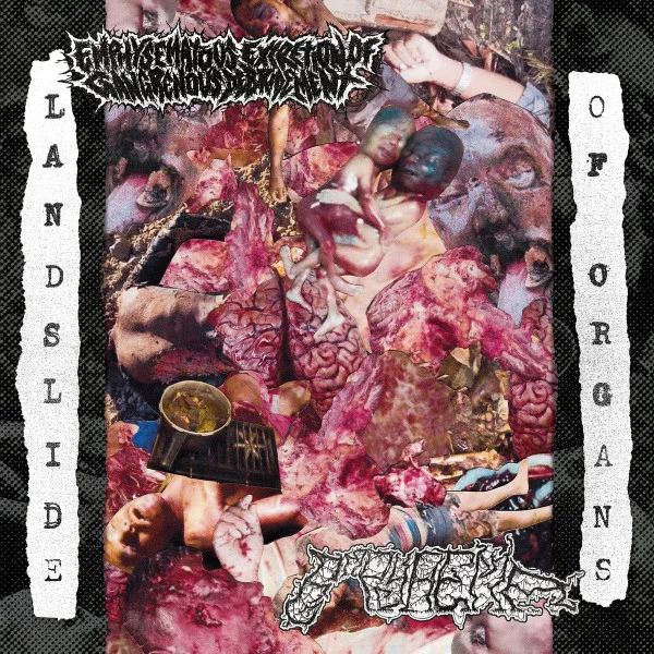Landslide of Organs cover