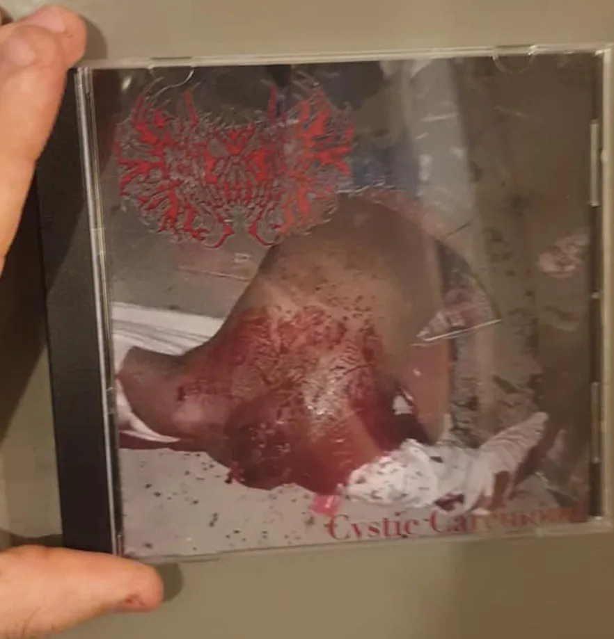Cystic Carcinoma cover