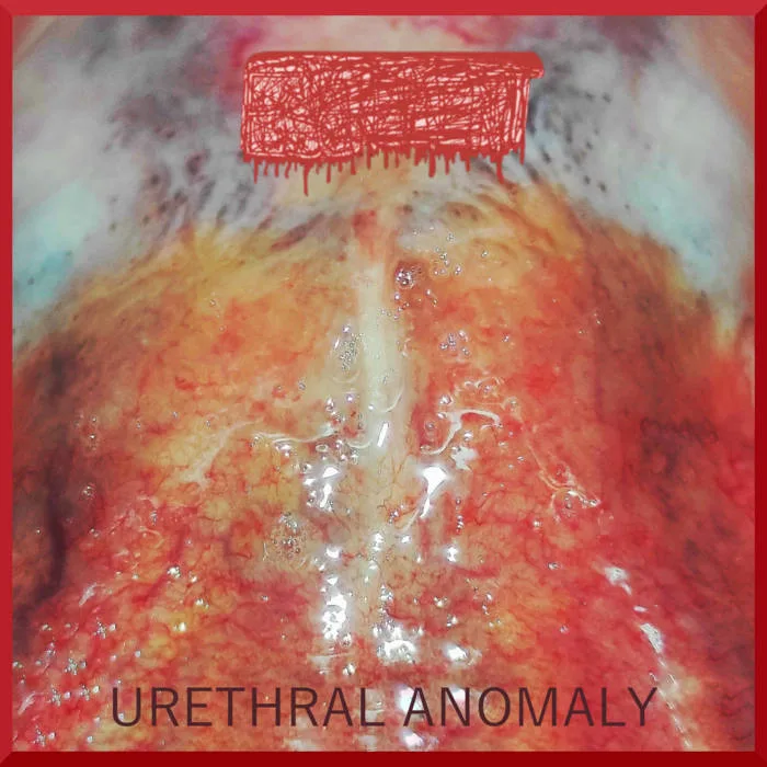Urethral Anomaly cover