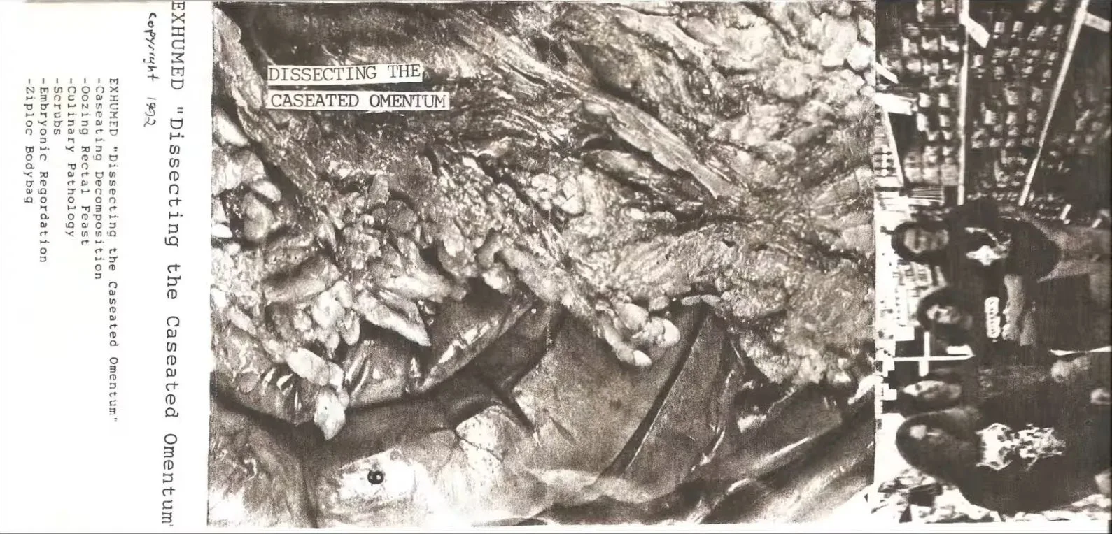 Dissecting the Caseated Omentum cover