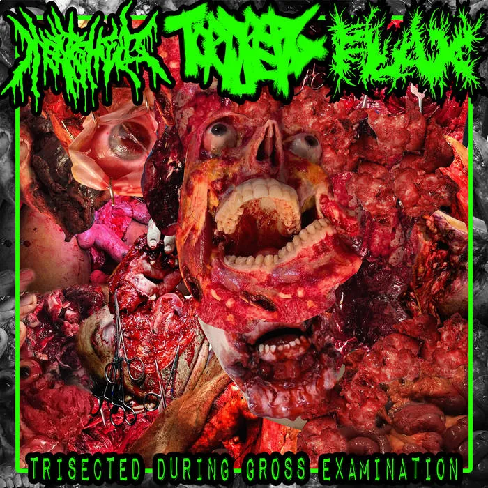 Trisected During Gross Examination cover