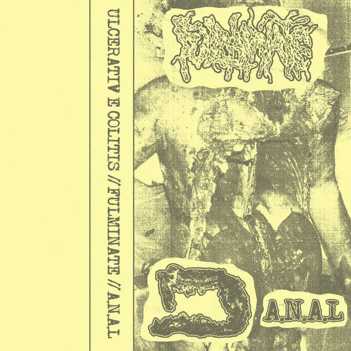 Ulcerative Colitis / Fulminate / A.N.A.L cover