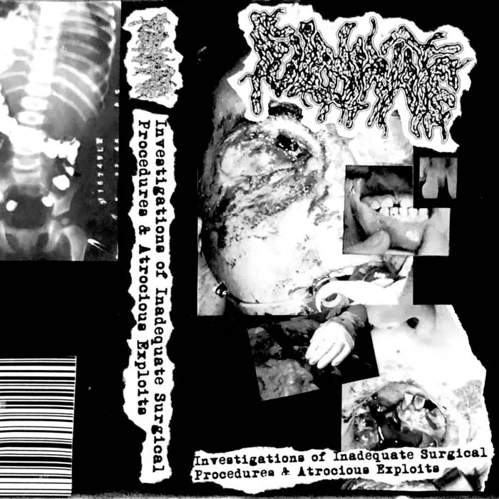 Investigations of Inadequate Surgical Procedures & Atrocious Exploits cover