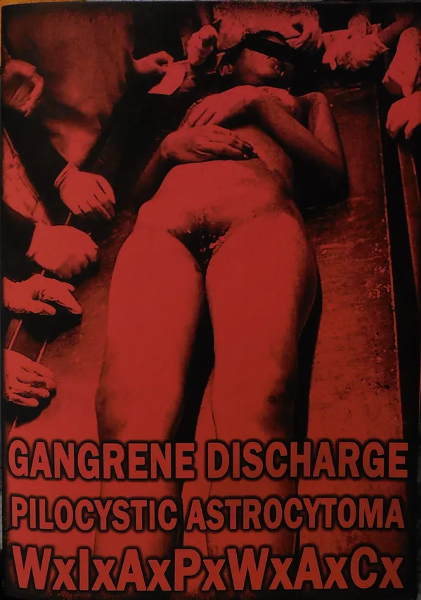 Gangrene Discharge / Pilocystic Astrocytoma / WxIxAxPxWxAxCx cover