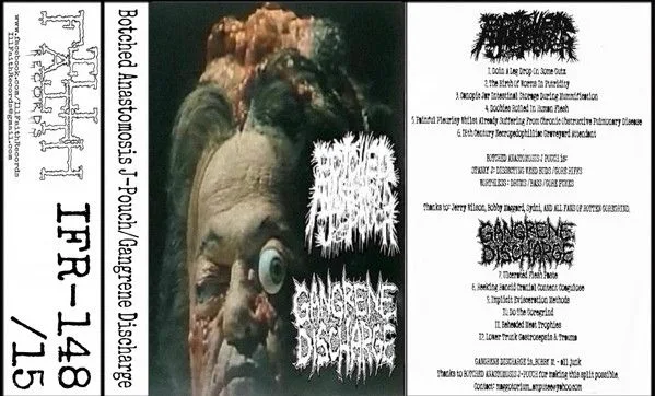 Botched Anastomosis J-Pouch / Gangrene Discharge cover