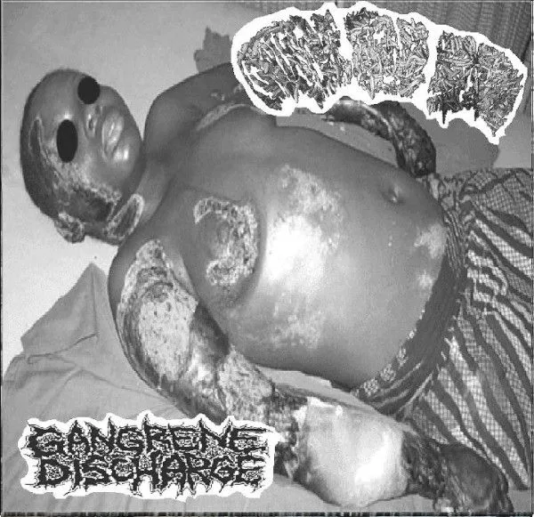 Grotesque Bowel Eruption / Gangrene Discharge cover