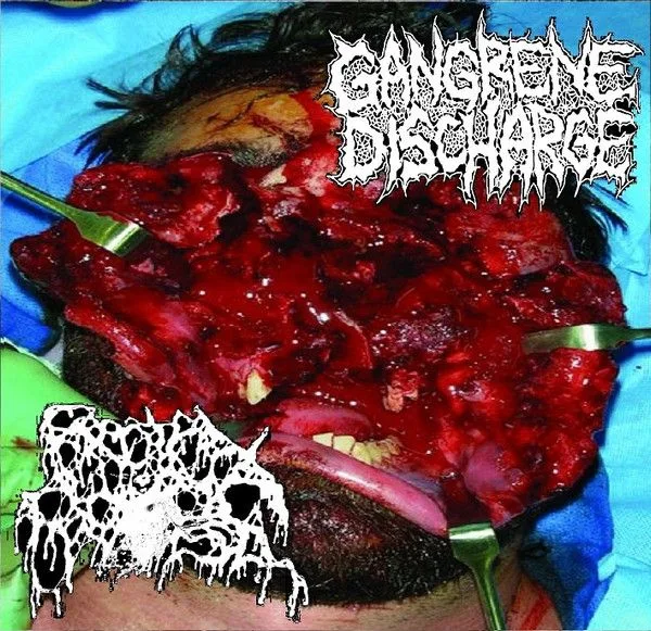 Gangrene Discharge / Rectal Prolapse cover
