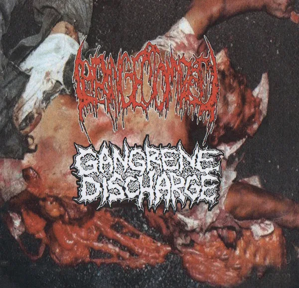 Laryngectomized / Gangrene Discharge cover