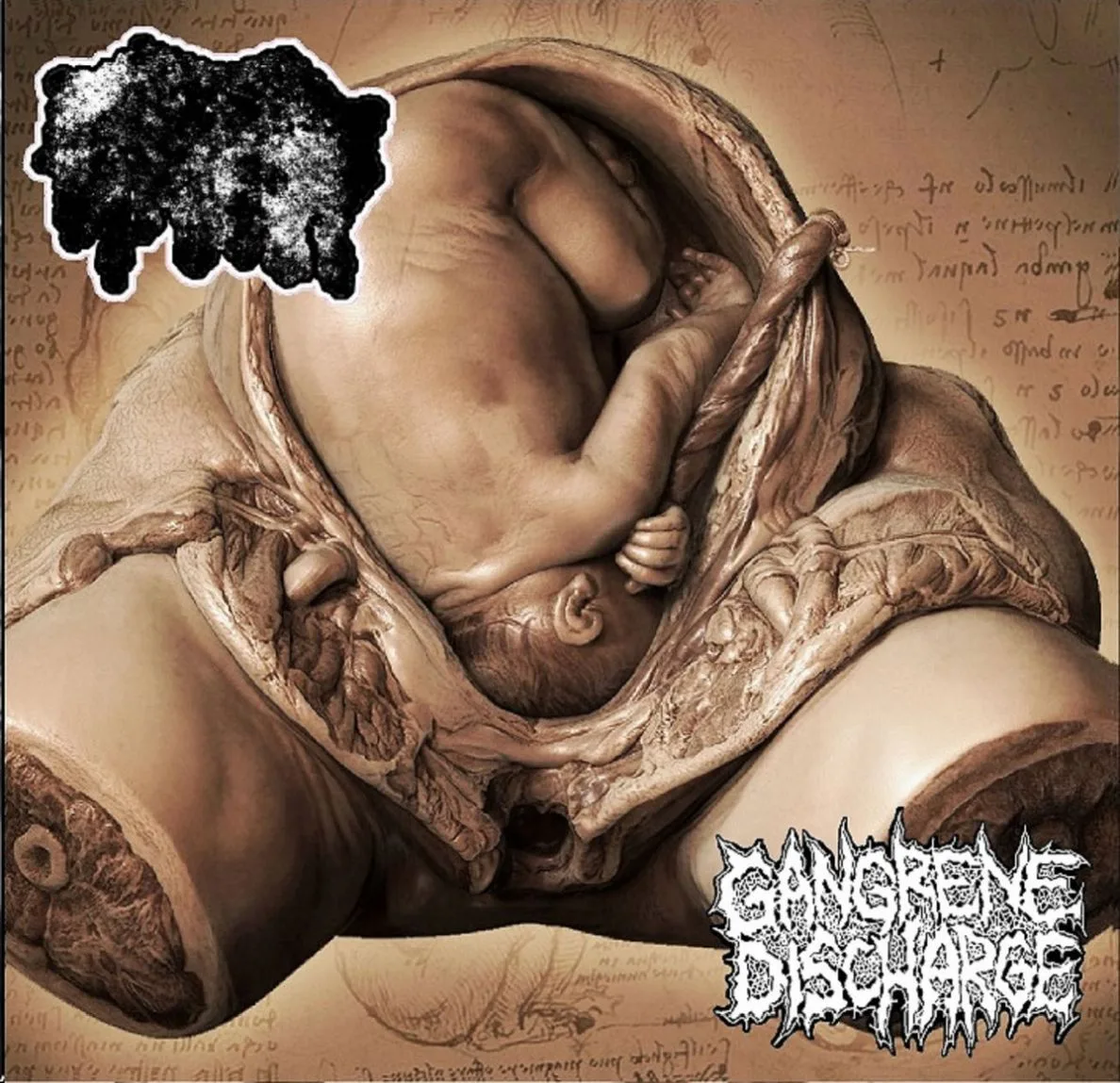 Fetus Demersus / Gangrene Discharge cover