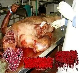 Corpus Luteum Cyst / Gangrene Discharge / Gangrenophagia cover