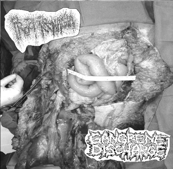 Proctorrhagia / Gangrene Discharge cover