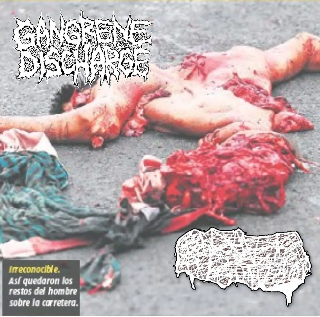 Gangrene Discharge / Cadaver Pouch Conveyor cover