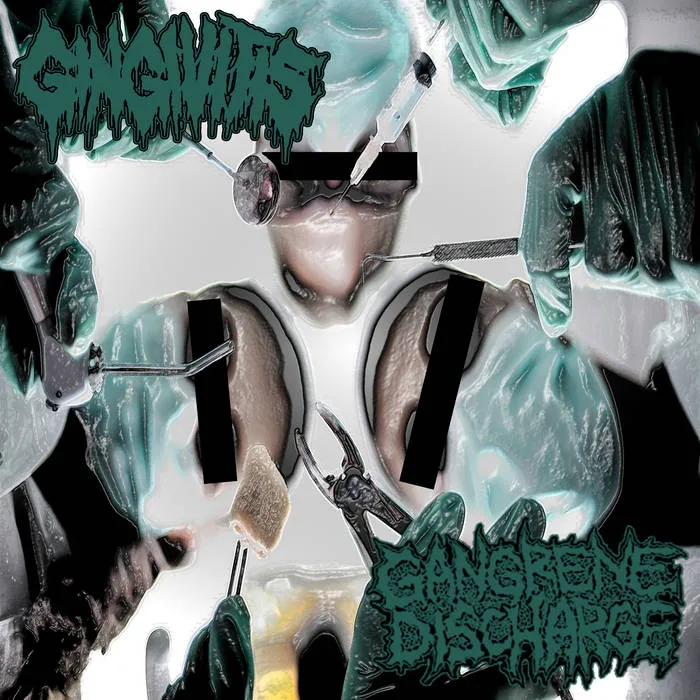 Gingivitis / Gangrene Discharge cover