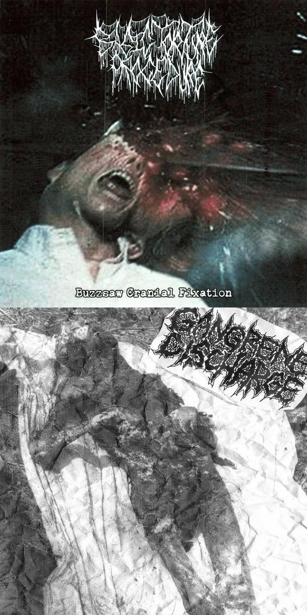 Buzzsaw Cranial Fixation / Untitled cover