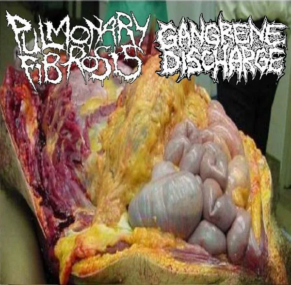 Pulmonary Fibrosis / Gangrene Discharge cover