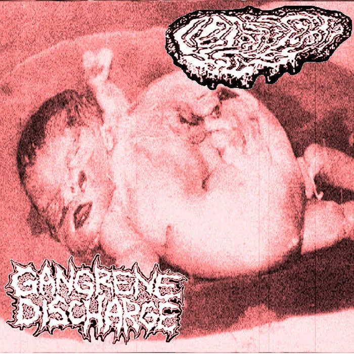 Fetal Deformity / Gangrene Discharge cover