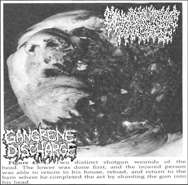Pancreatic Pancake / Gangrene Discharge cover