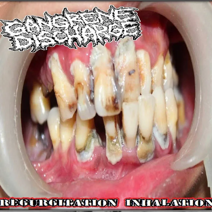 Regurgitation Inhalation cover