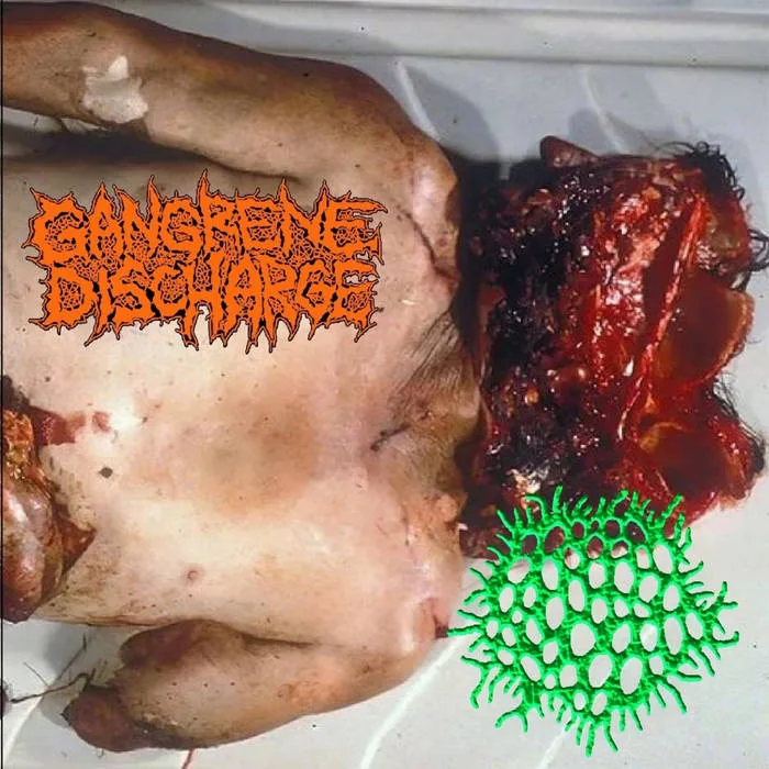 Gangrene Discharge / Laparoscopic Hysterectomy cover