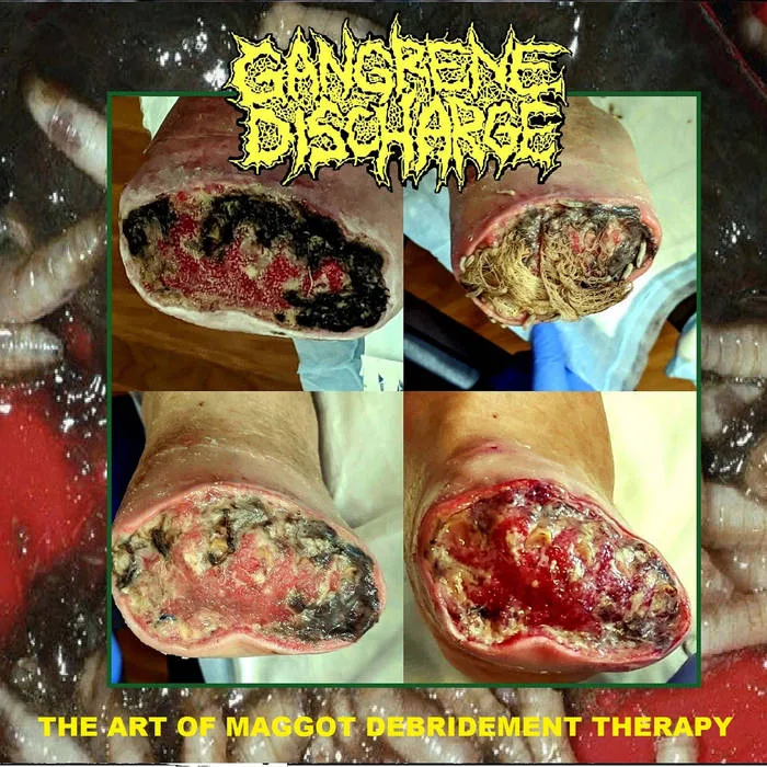The Art of Maggot Debridement Therapy cover