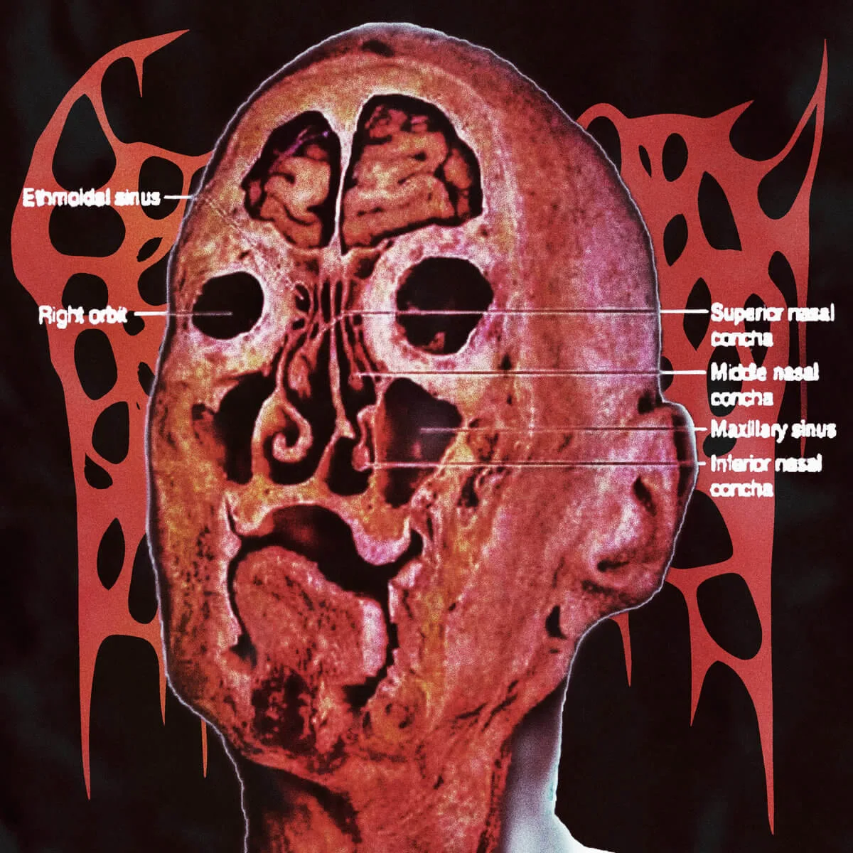 Seismic Cerebral Collapse cover